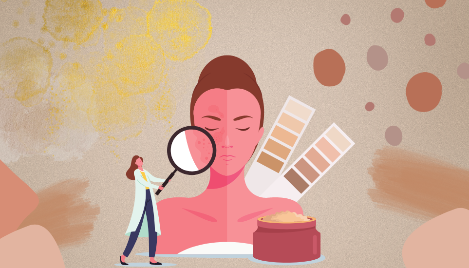 Macchie solari: prevenzione e cura