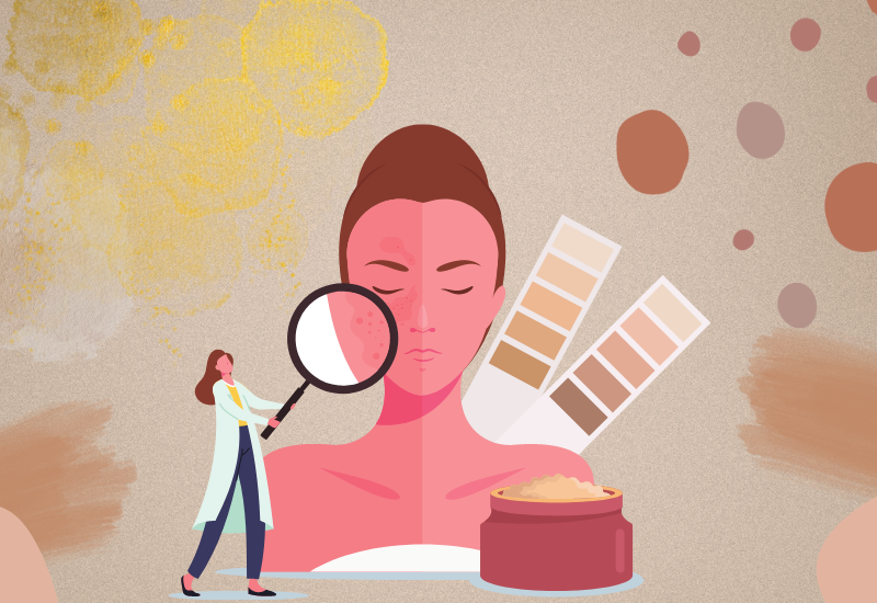 Macchie solari: prevenzione e cura
